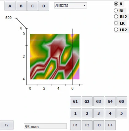 تحلیل لکه های رنگی در نرم افزار کالرپرو